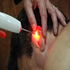 Curso de Acupuntura a Laser