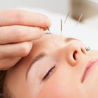 Curso Acupuntura Estética Corporal e Facial Avançado