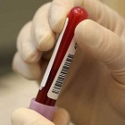 Curso Interpretação do Hemograma